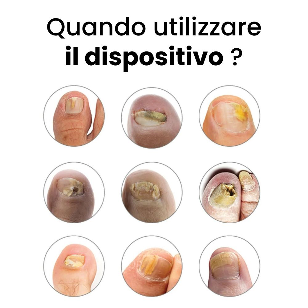 Dispositivo OrthoVital
